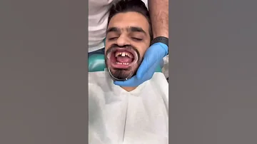 مراحل صناعه ابتسامتي 