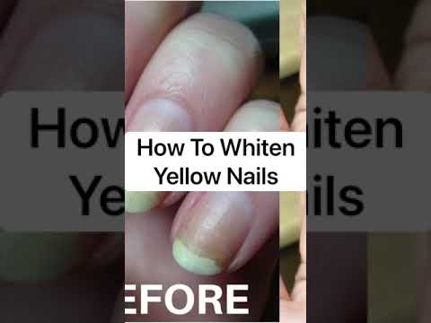 Nail Hack To