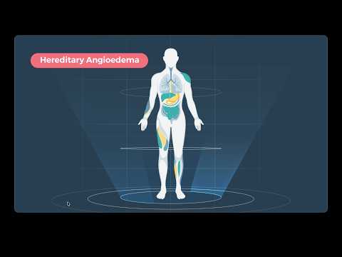 Hereditary Angioedema (HAE) Explained