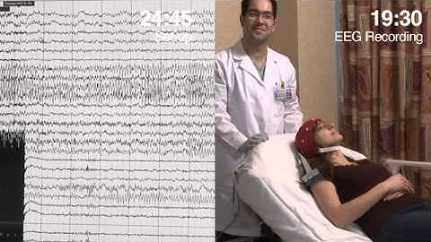 microEEG® vs. Standard EEG System