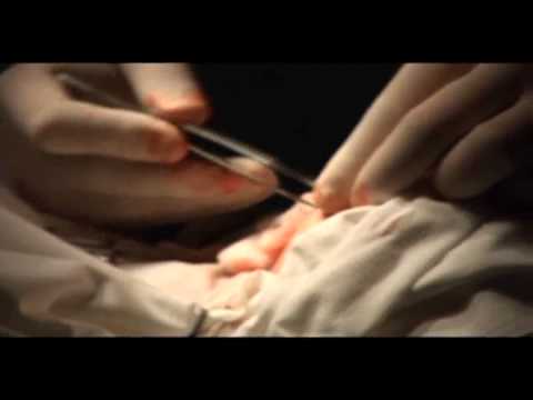 რინოპლასტიკა-გადაცემა ემერჯენსი / Emergency