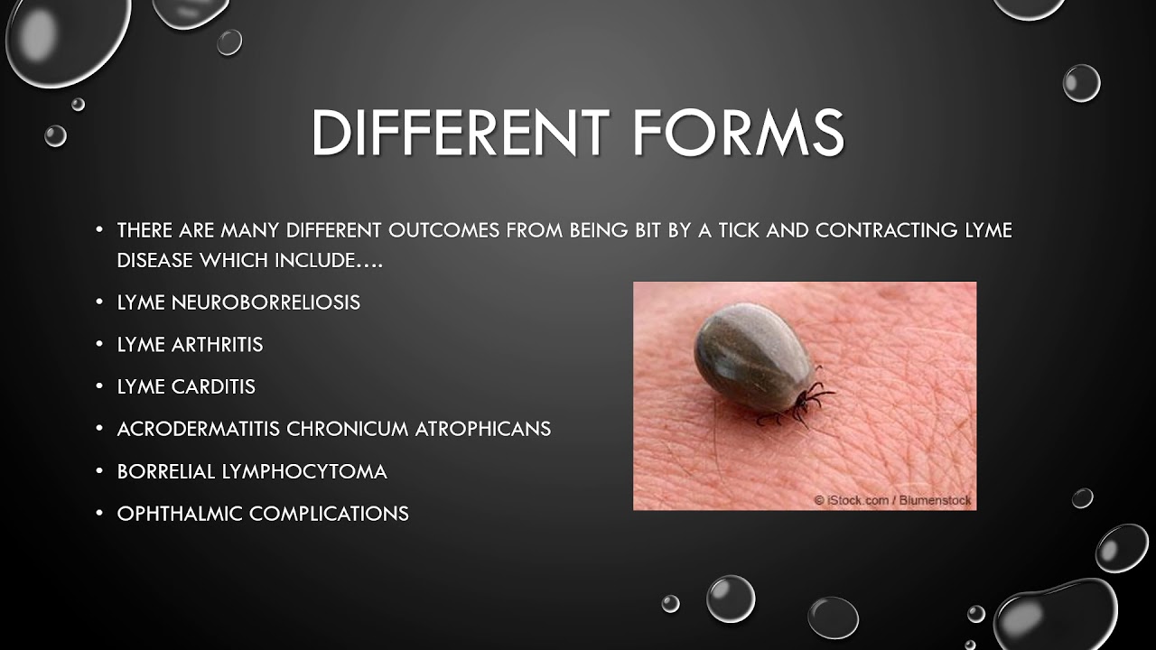 Lyme Disease FINAL PROJECT video