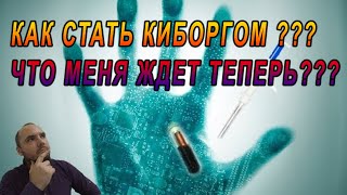 Путь становления киборгом: КАК Я ВЖИВИЛ СЕБЕ МИКРОЧИП rfid и nfc