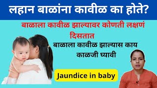 लहान बाळांना कावीळ झाल्यावर काय होतं|Balala kavil zalys kay upay karave| jaundice in baby in marathi