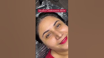 She loved her healed result of combination eyebrow treatment