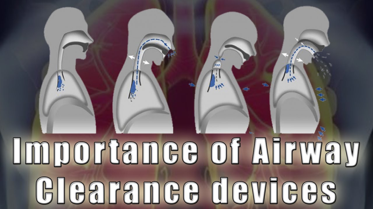 Importance of Airway Clearance devices YouTube