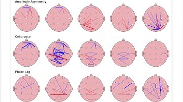 QEEG