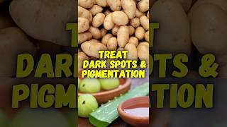 Treat dark spots and pigmentation with potato and amla ashortaday pigmentation trending