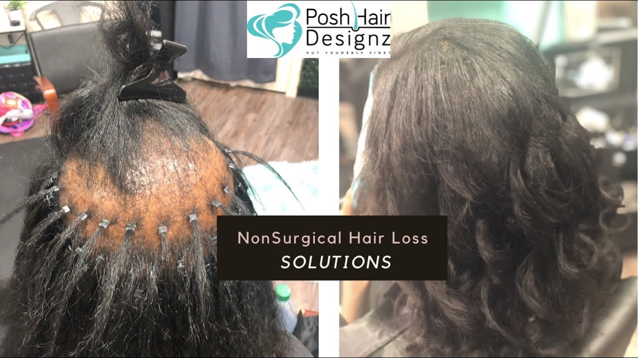 Hair Loss Solution Touch Up  |I-Tips |Braidless Sew in Installation