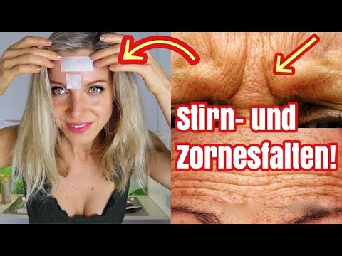 Mit diesen 4 günstigen Tricks Stirn-Falten glätten! Ohne teures Botox!  *Haut-Verjüngung mal anders