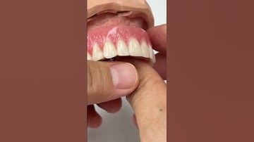 Removable denture!