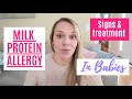 CMPA IN BABIES | SIGNS OF MILK PROTEIN ALLERGY | MILK PROTEIN INTOLERANCE | BREASTFED BABY
