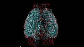 APPS1 mouse brain imaged with mesoSPIM at 2X