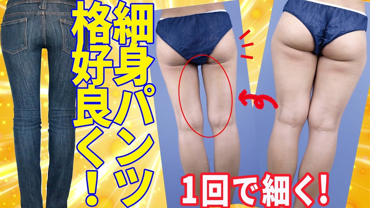 脚やせ】ミニやスキニーもOK！脂肪吸引なら1回で細くすっきり美脚に