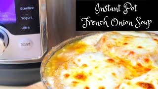 French Onion Soup - Instant Pot Recipe (So Easy!)
