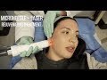 Micro-Needling and Laser Facial  Vlog | Viva & Vivace Treatment | Solange Nicole