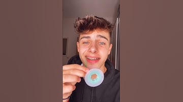 Kyle Thomas 💙 changing my braces for the last time EVER 😭 #kylethomas #shorts