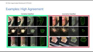 Agreement Between Saliency Maps and Human-Labeled Regions of Interest