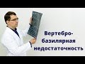 Вертебро базилярная недостаточность: правда или миф? Все о диагнозе ВБН