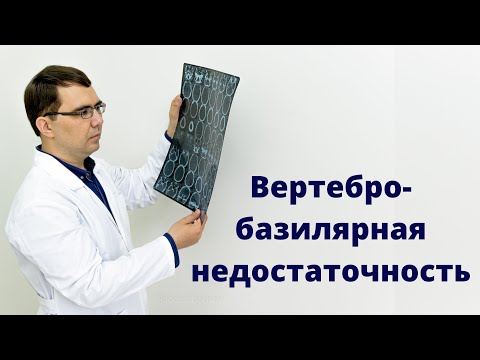 Вертебро базилярная недостаточность: правда или миф? Все о диагнозе ВБН