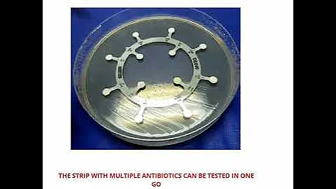 E Test for antimicrobial sensitivity test