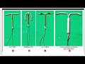Family Planning Method &amp; Contraception #familyplanning #condoms #Coper-t20
