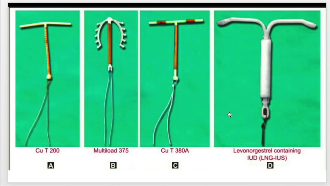 Family Planning Method & Contraception 