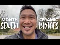 ARE MY TEETH STAINING?! | Month SEVEN - Braces Journal | My Ceramic Braces