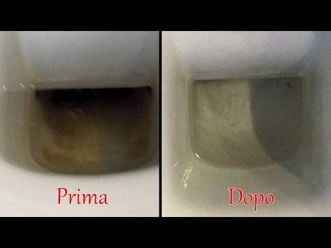 Video: Come pulire le protesi con l'aceto: 12 passaggi (con immagini)