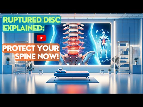 Video: Sequestration Of A Herniated Disc - Causes, Symptoms And Treatment