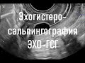 Эхогистеросальпингография Эхо-ГСГ