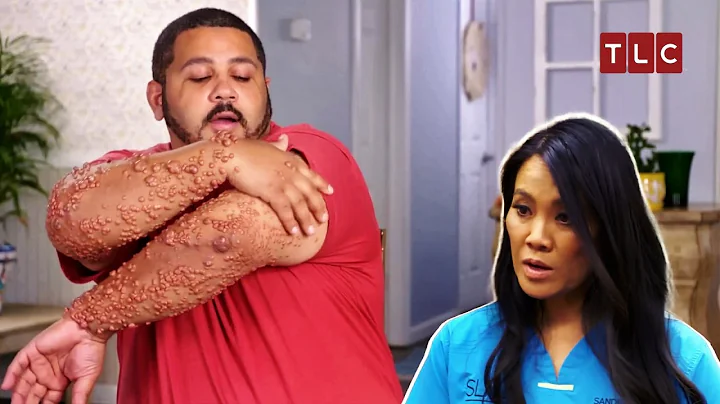 The Strangest Case of Dr Lee’s Career! | Dr Pimple Popper TLC