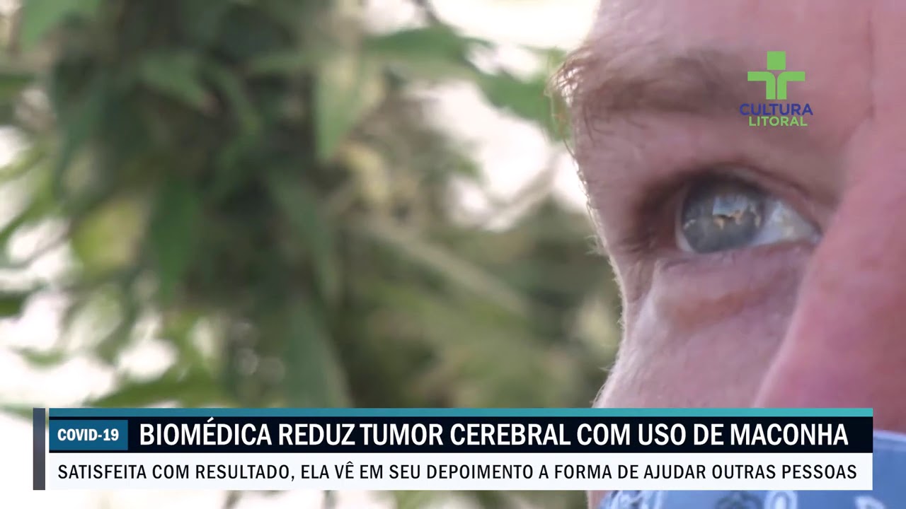Biomédica reduz tumor cerebral com uso de maconha