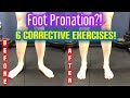 “Flat Feet/Duck Feet” *Foot OVERPRONATION* 6 BEST CORRECTIVE EXERCISES! | Dr Wil & Dr K