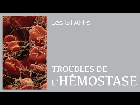 Vidéo: Hémostase Endoscopique Suivie D'une Embolisation Transartérielle Préventive Chez Les Patients à Haut Risque Atteints D'ulcère Gastroduodénal Saignant: 5 Ans D'expéri