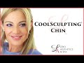 CoolSculpting Chin 2018