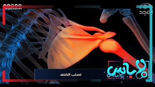 أعراض تصلب الكتف.. كيف يبدأ الألم؟ د. عمرو سعيد | استشاري علاج الألم| برنامج لابأس