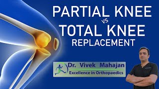 How knee replacement is done Successfully drvivekmahajan painrelief