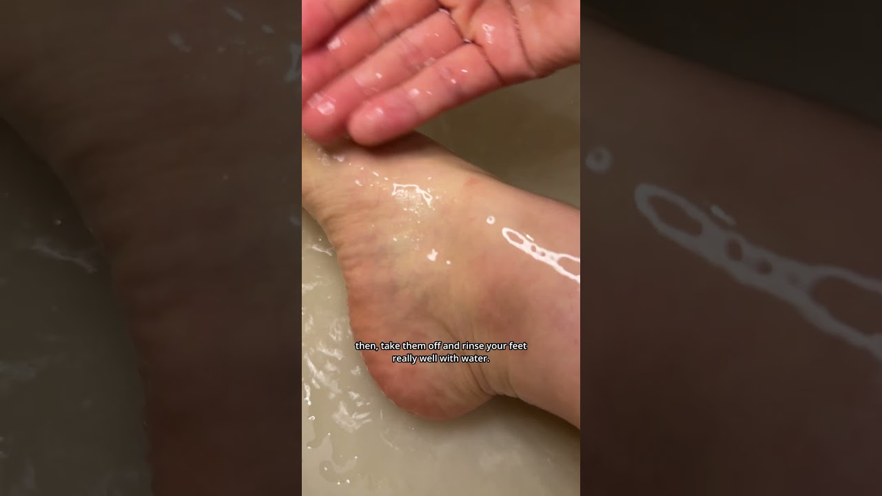 Peel , repair and bring your feet back to life. 🦶🏻 #footcare #footcaretips #footcareroutine