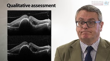 SPECTRALIS OCT: Interpreting the image