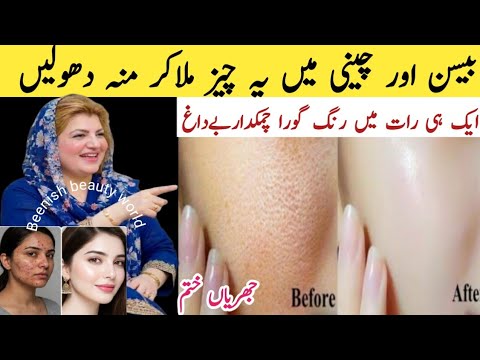 Besan face mask for glowing White skin /daily besan face wash /instant whitening tan removing remedy