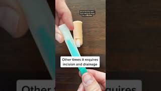 GROSS FINGER INFECTION | Treating Paronychia