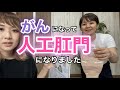 【人工肛門】オストメイトって知ってますか?【がんサバイバー】