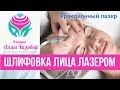 Фракционный лазер СО2. Лазерная шлифовка в Москве. Процедура лазерной шлифовки. Углекислотный лазер.