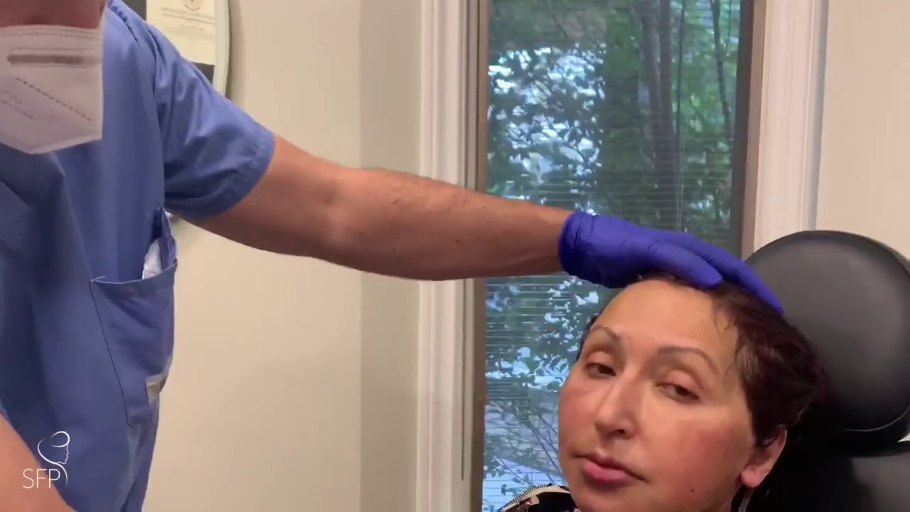 Facelift Surgery Garment Change & Drain Monitoring by Dr. Philip