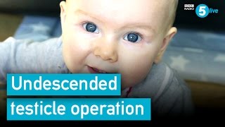 Undescended testicle operation: A parent's advice
