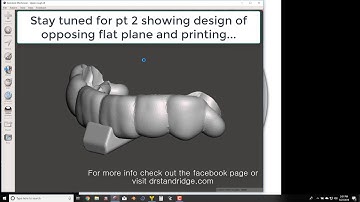 Anterior Deprogrammer Design using D3Splint (Pt 1)