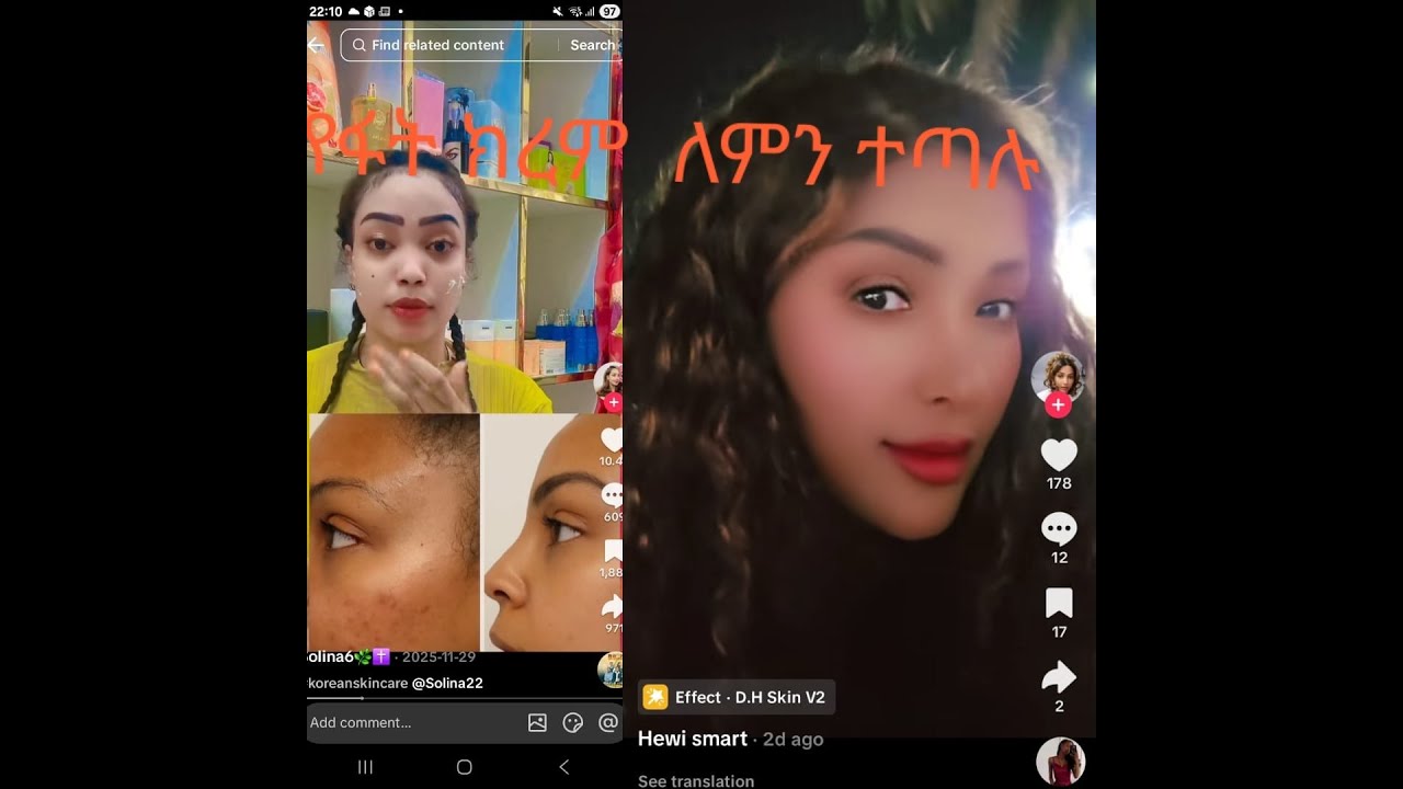 እሀንን ሳታዮ የፈት ክርም አትጠቀሙs broadcast