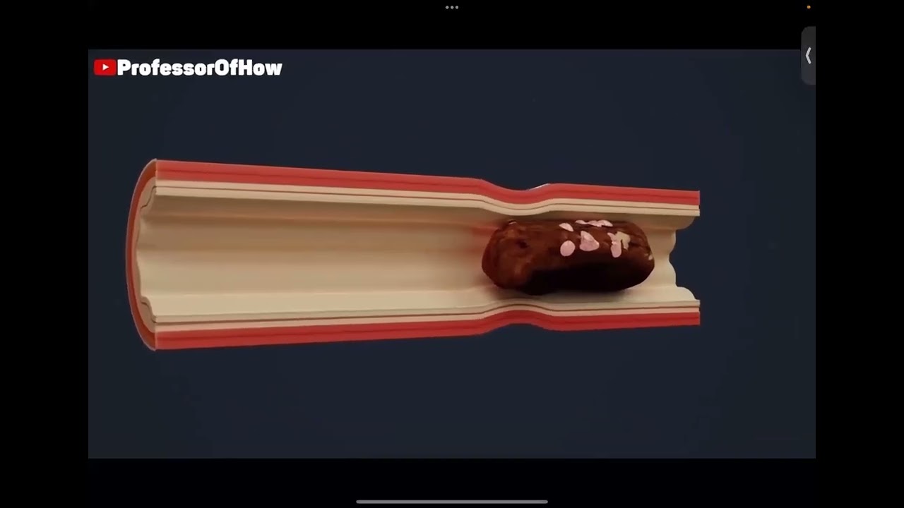 15 Online Summer Camp 2025 - Science Video: How Digestive system works? Madinah Arabic Reader; Quiz