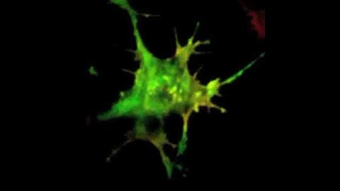 Live imaging of an axon growth cone